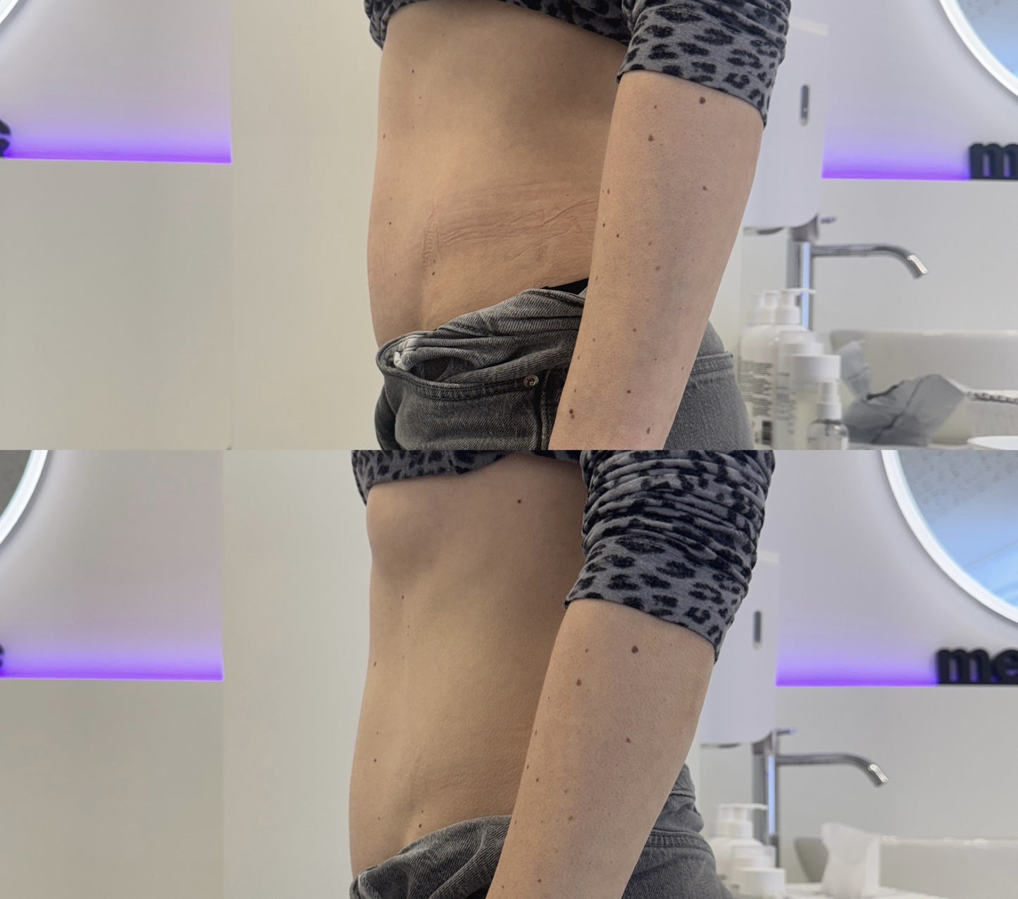 Voucher BodyShock behandeling 10 behandelingen + 30% korting op de BodyShock producten