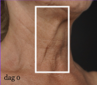 mesoestetic skinretin body cream