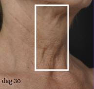 Mesoestetic Skinretin Body Cream – anti-aging body crème met retinol voor strakkere huid